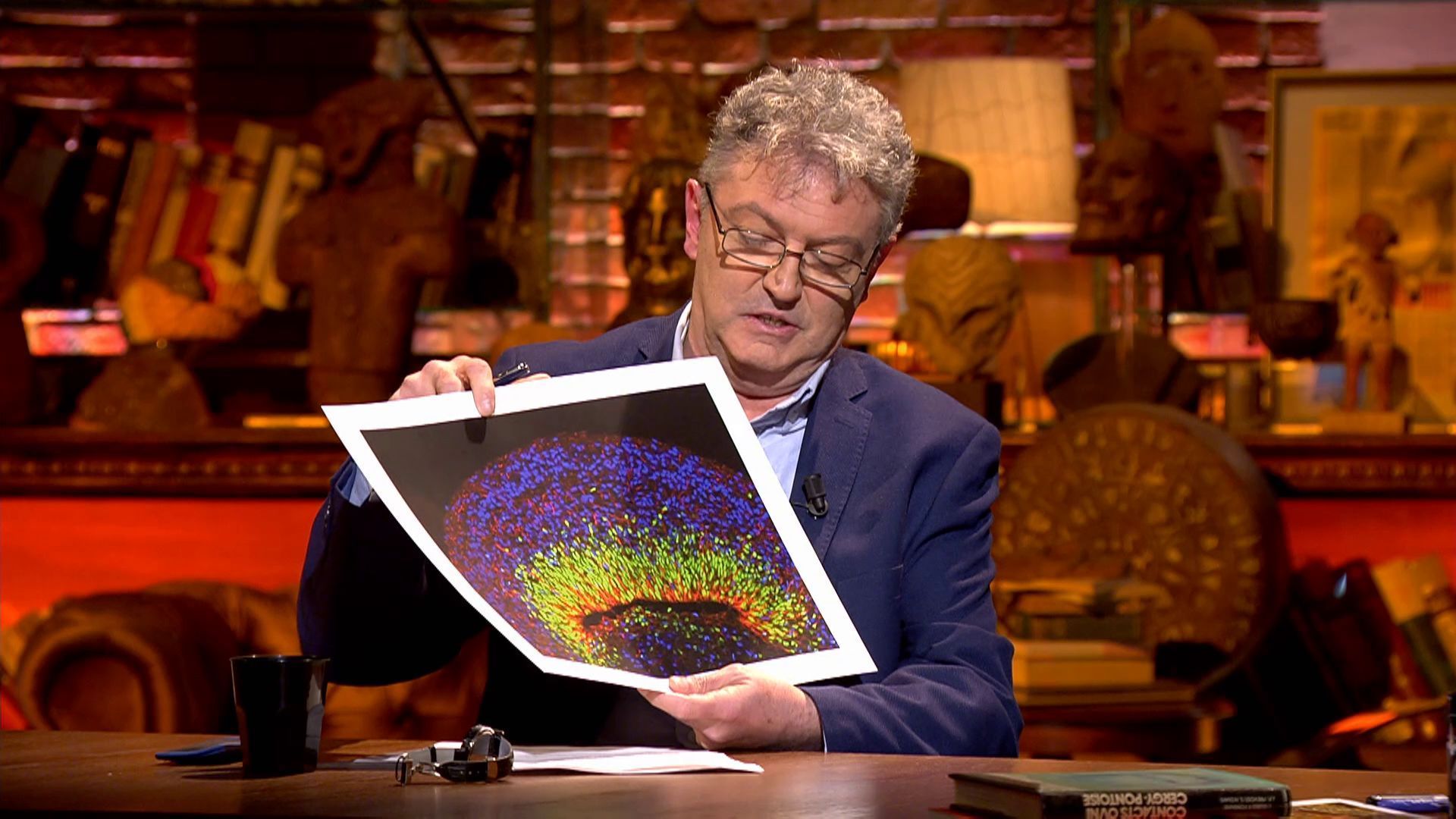 El doctor Loeches detalla los avances de los minicerebros