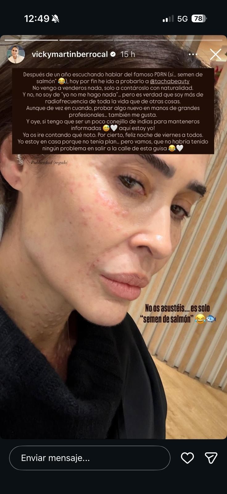 Vicky Martín Berrocal esperma de salmón