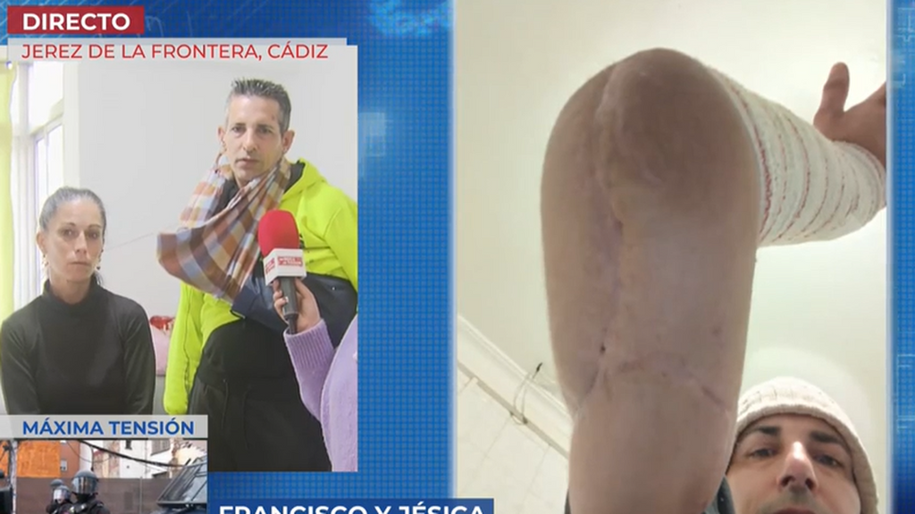 Apuñalado con una espada por su inquiokupa: “Casi me mata”