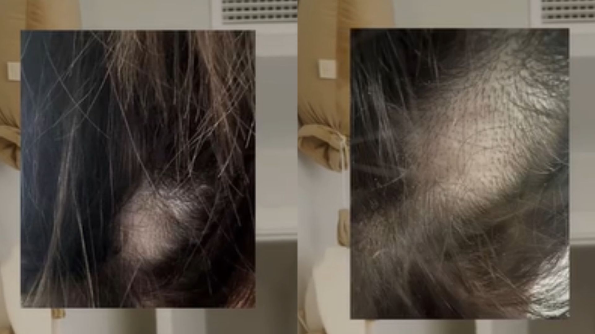 La angustia de Noemí Salazar al hablar por primera vez de un problema de salud: "Me desmayé y llegué a convulsionar"