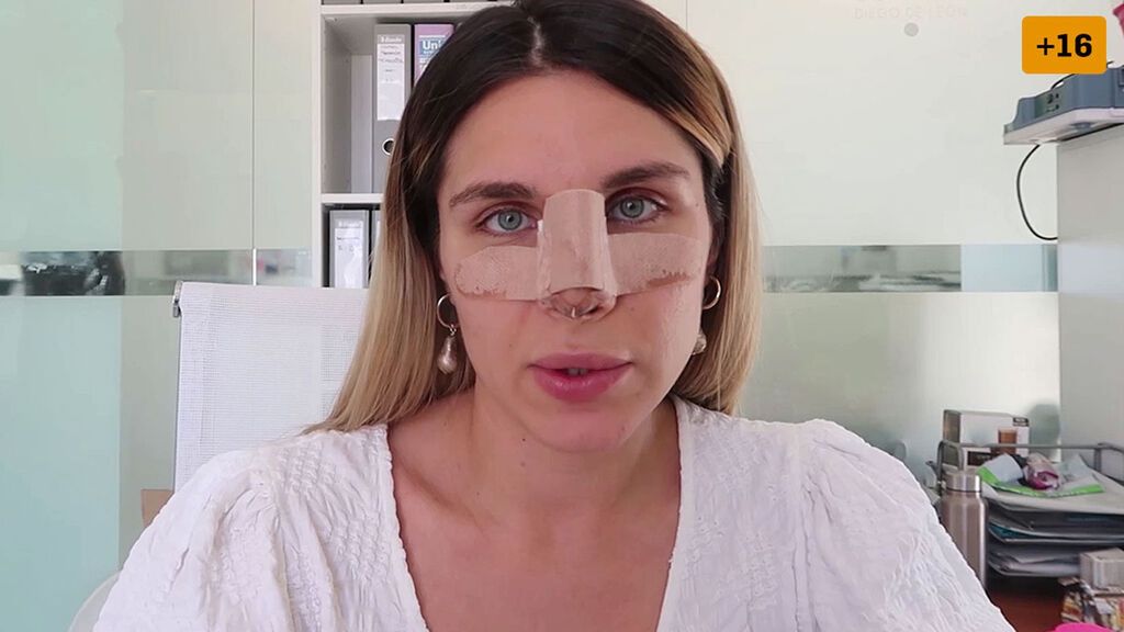 Ivana Icardi muestra el resultado de su operación de nariz (1/2)