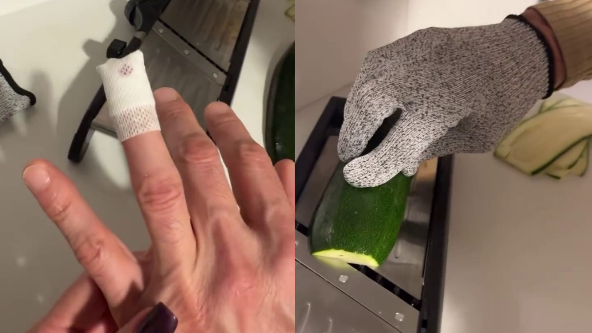 Las imágenes de Makoke y Gonzalo tras su paso por urgencias