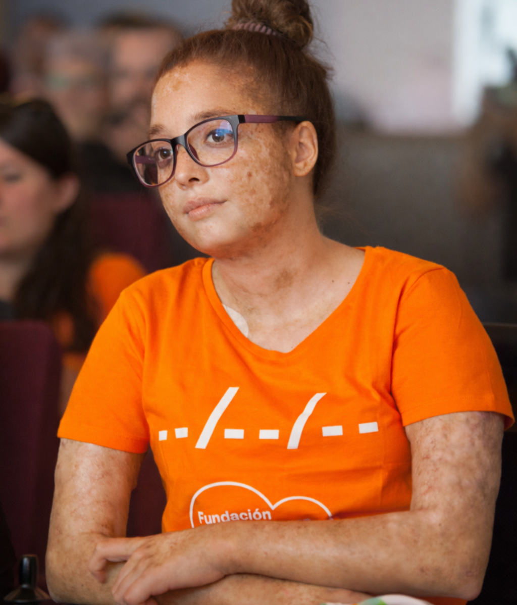 Sara actualmente con una gran afectación en su piel