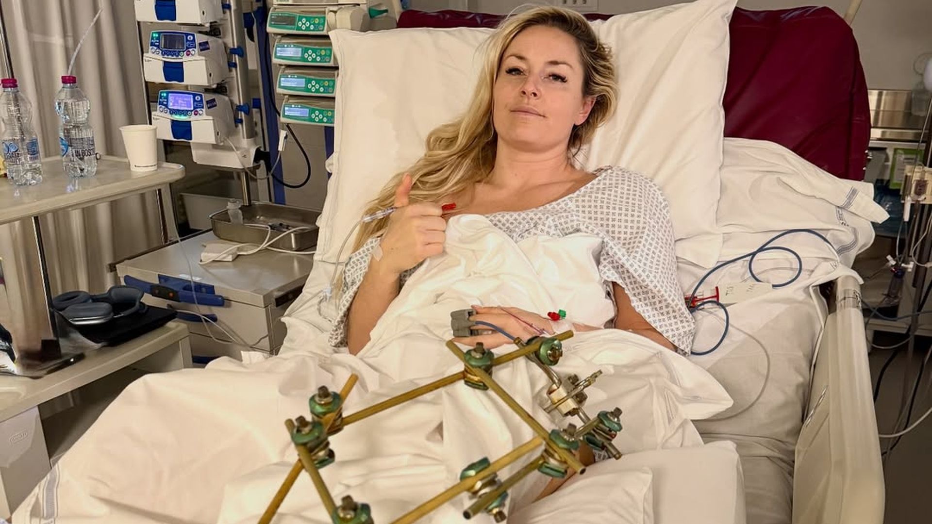 Lindsey Vonn, tras tres operaciones
