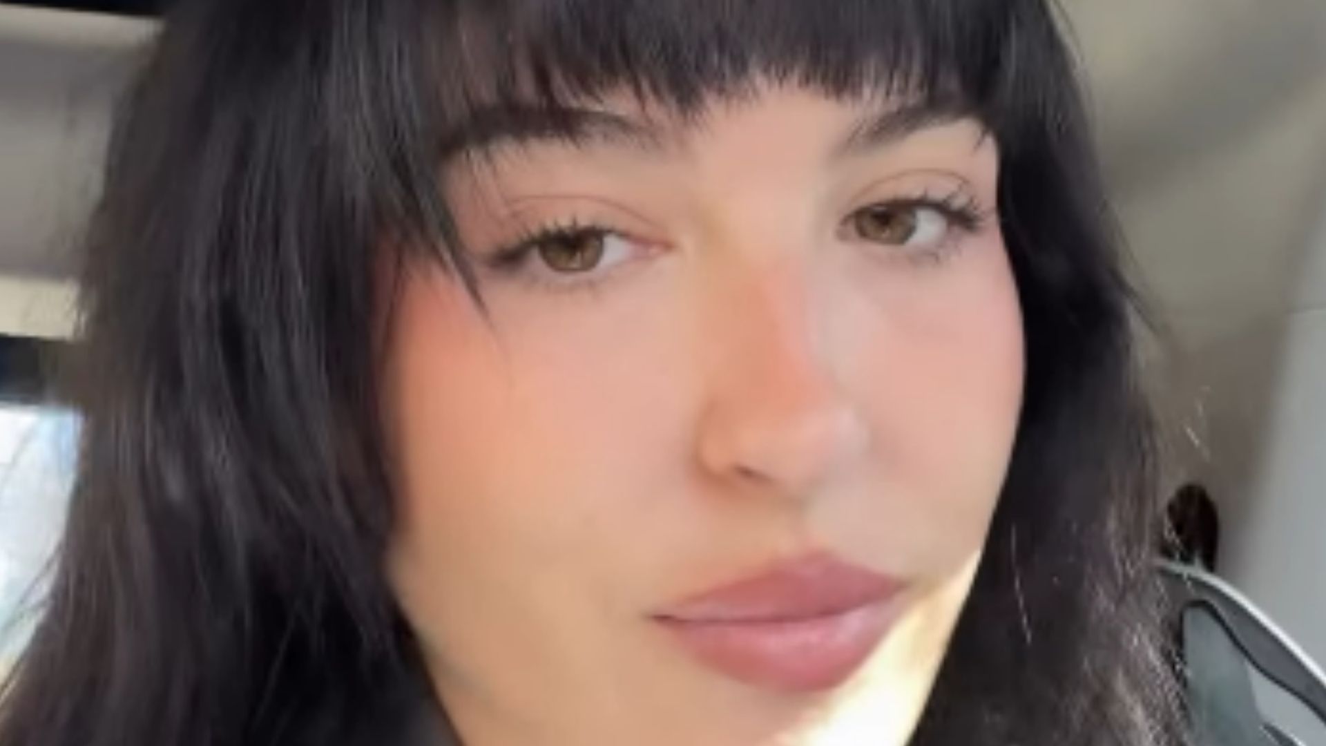 Alba Díaz, al límite, pide ayuda por un problema de salud: "Se me sube hasta el ojo"