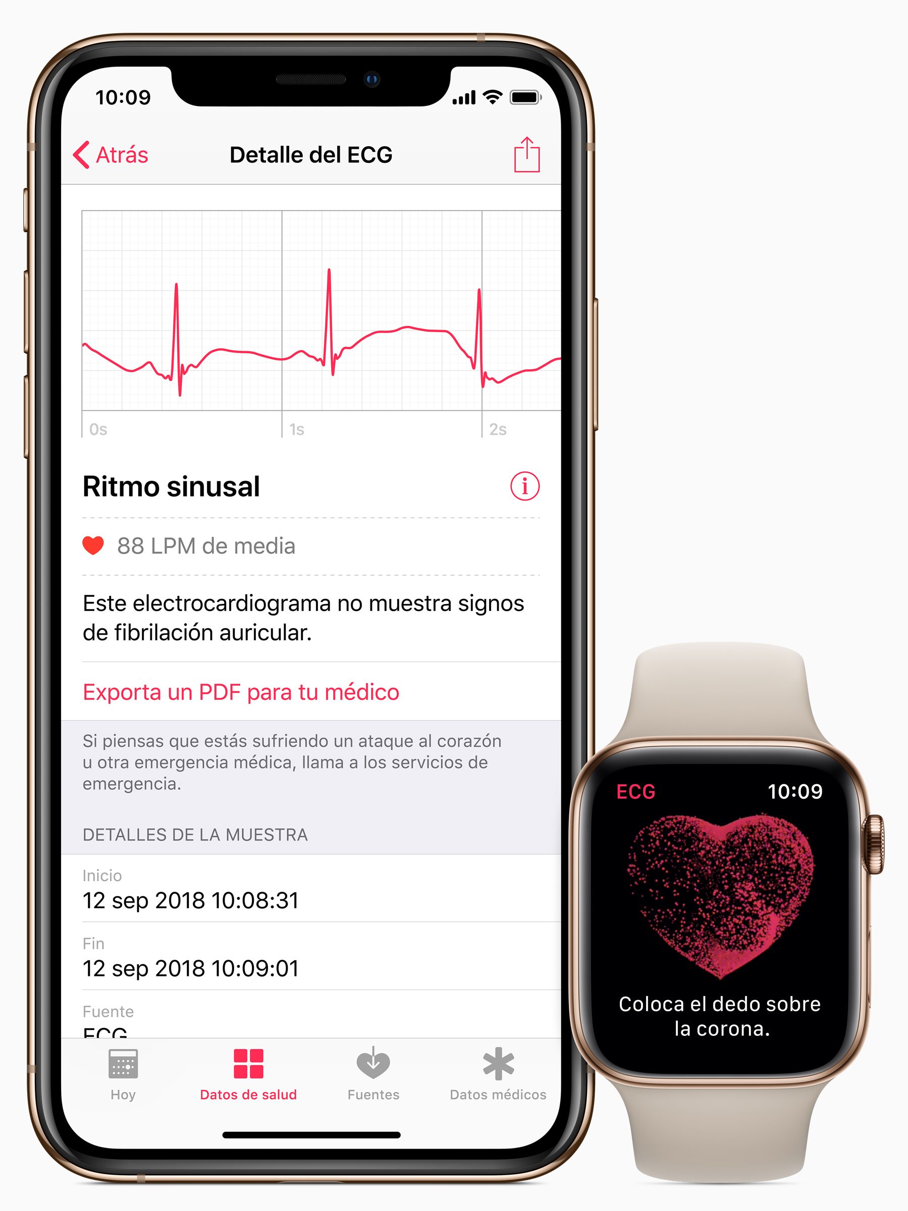 Resultados de un electrocardiograma realizado con un Apple Watch que muestran un ritmo sinusal