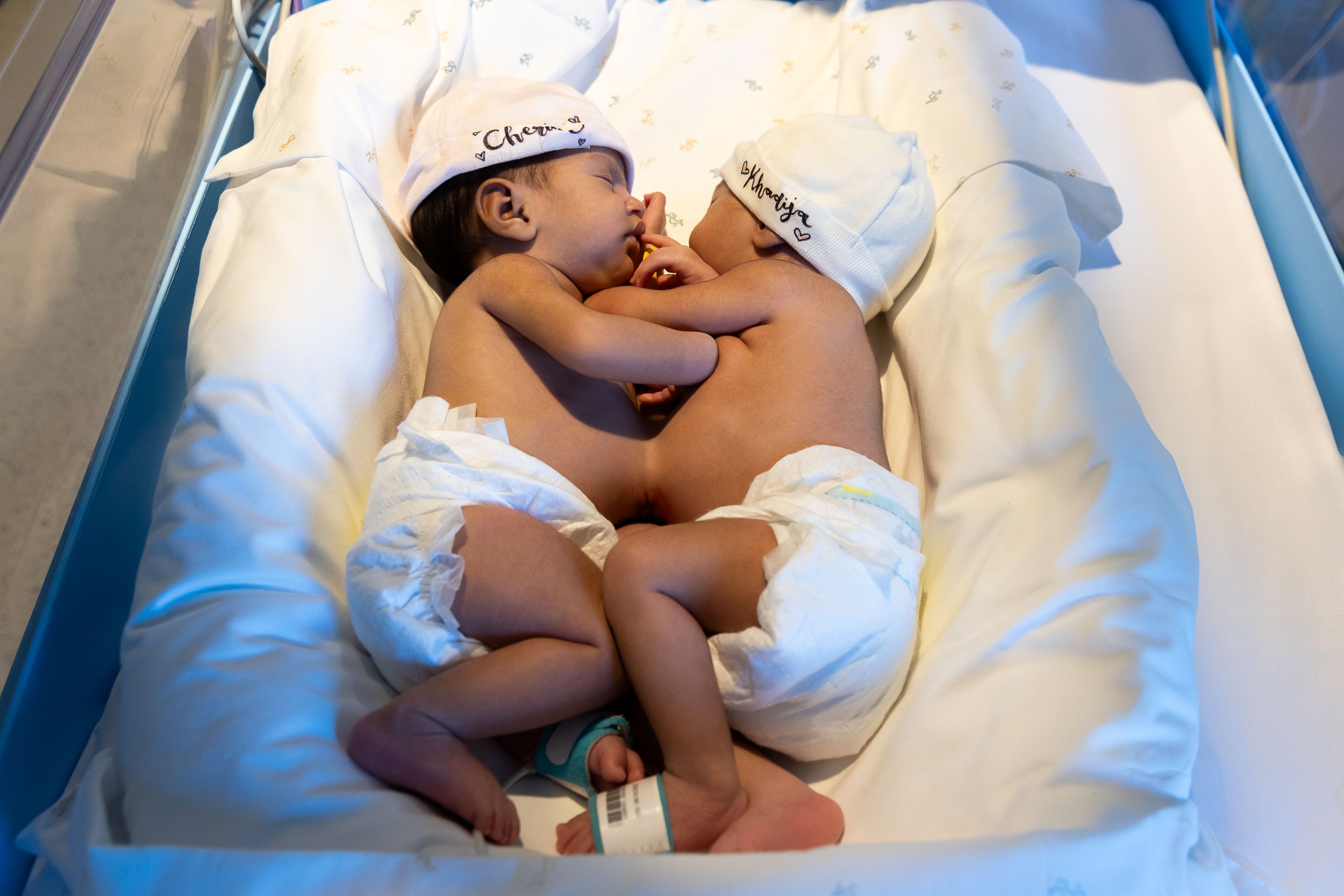 Las siamesas a su llegada en 2023 a Barcelona