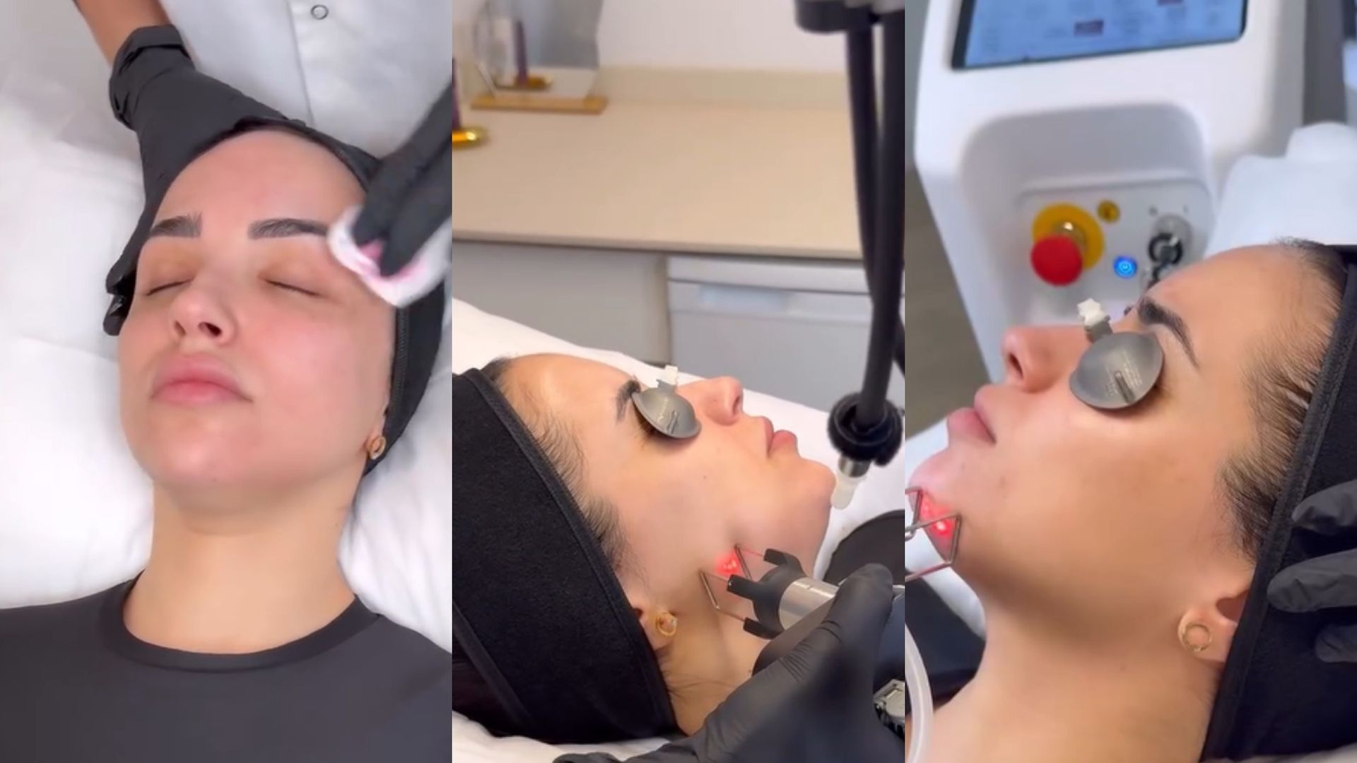 Lucía Sánchez se somete a un láser CO2: qué es y en qué consiste