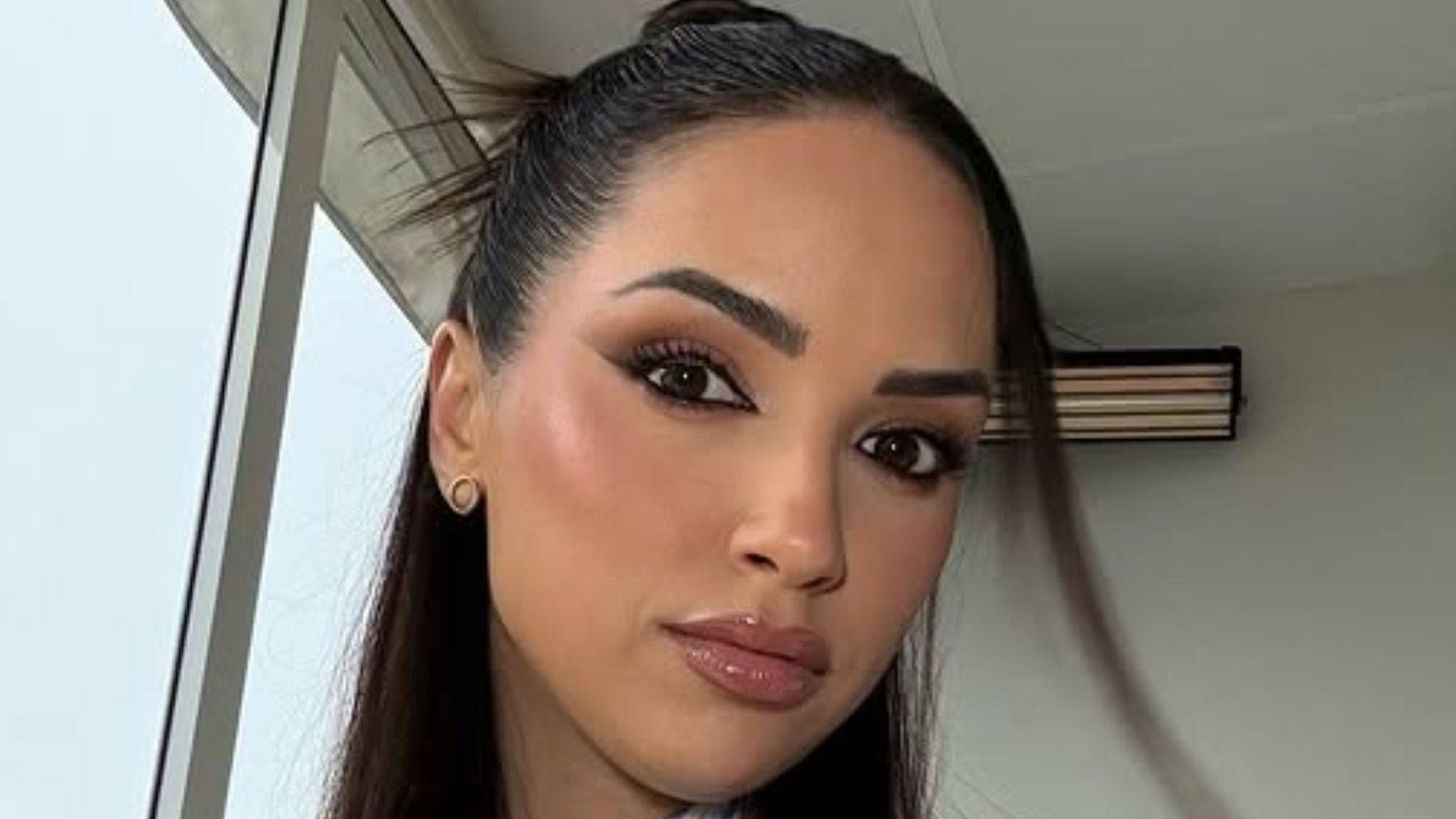 Lucía Sánchez se somete a un láser CO2: qué es y en qué consiste Lucía Sánchez se somete a un láser CO2: qué es y en qué consiste