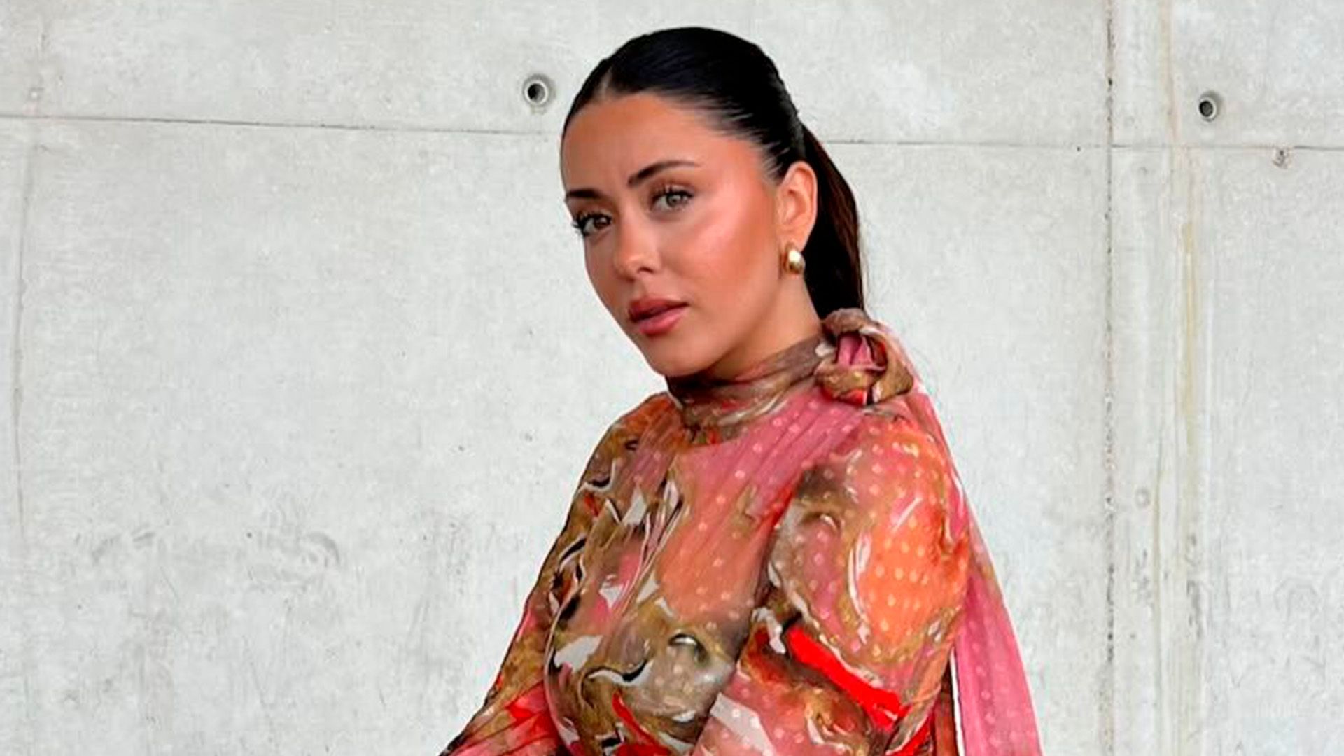 Rosario Matew muestra las secuelas físicas que arrastra tras su paso por ‘Supervivientes’