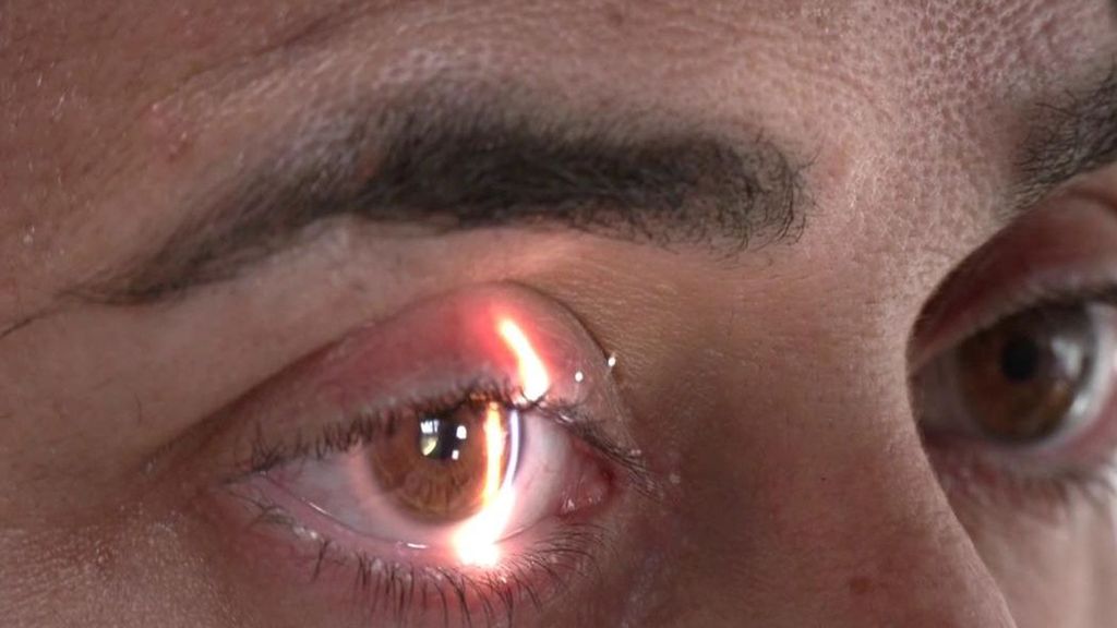 Cribados para detectar el alzheimer en el optalmólogo va a ser posible: el ojo es una puerta al cerebro
