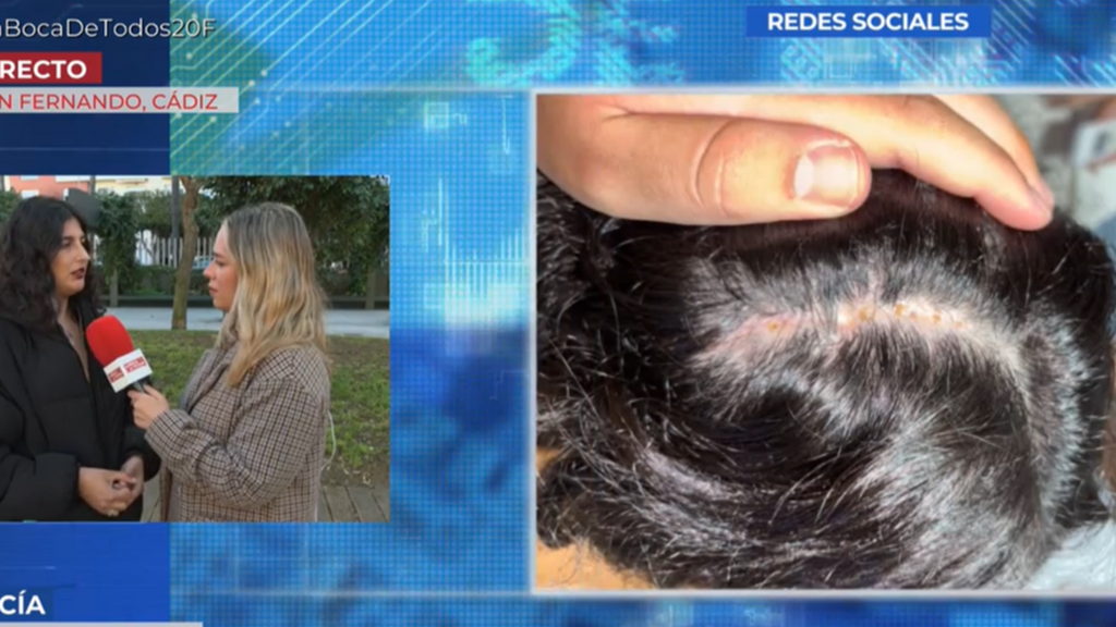 Lucía, sobre la brutal agresión que sufrió a manos de su expareja: “Me dio martillazos en la cabeza y trató de asfixiarme”