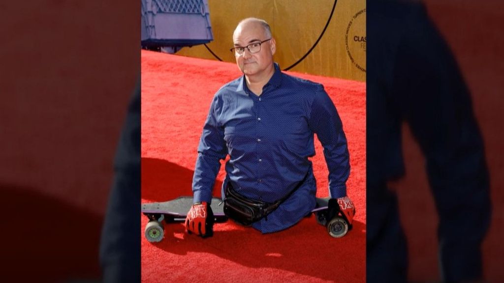 Así es la historia de Matthew Demeritt, el actor sin piernas que dio vida a ET a sus 11 años