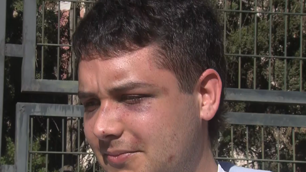 Pablo, agredido a la salida de una discoteca: "Querían básicamente un trofeo y tenían ganas de pegar a alguien"