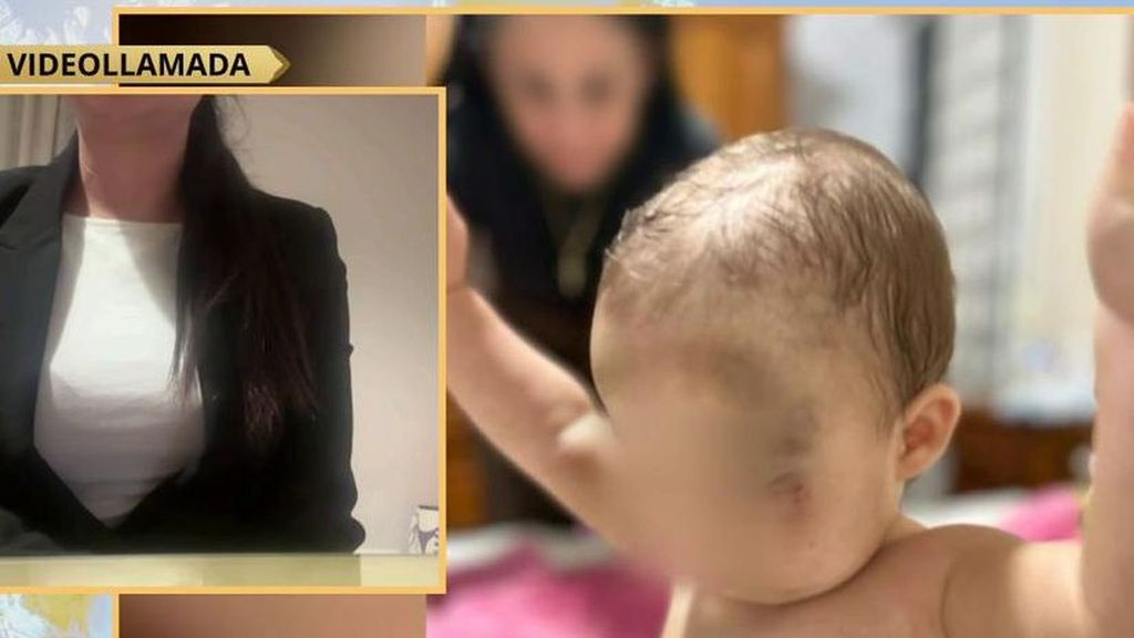 Madre del bebé presuntamente agredido en una guardería de Sevilla: "Hay heridas físicas y psicológicas"