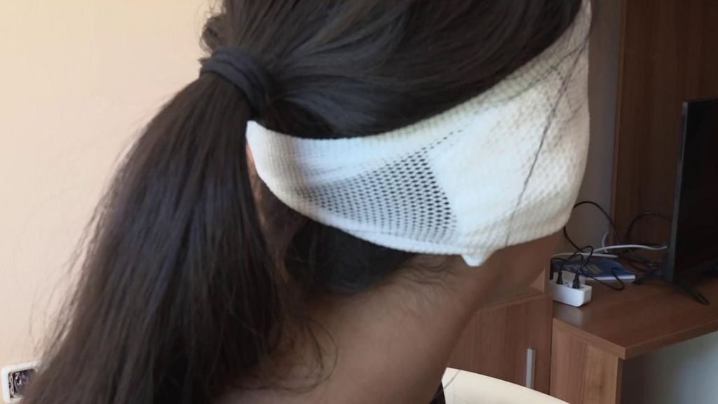 La madre de la menor a la que arrancaron parte de una oreja en Murcia: "Le agarró del pelo, le mordió y le dejó el cartílago desnudo"