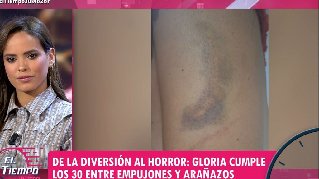 Gloria Camila reacciona en 'El tiempo justo' a las acusaciones de una joven en su 30 cumpleaños, que asegura: "Me dio un empujón y me arañó en el brazo"