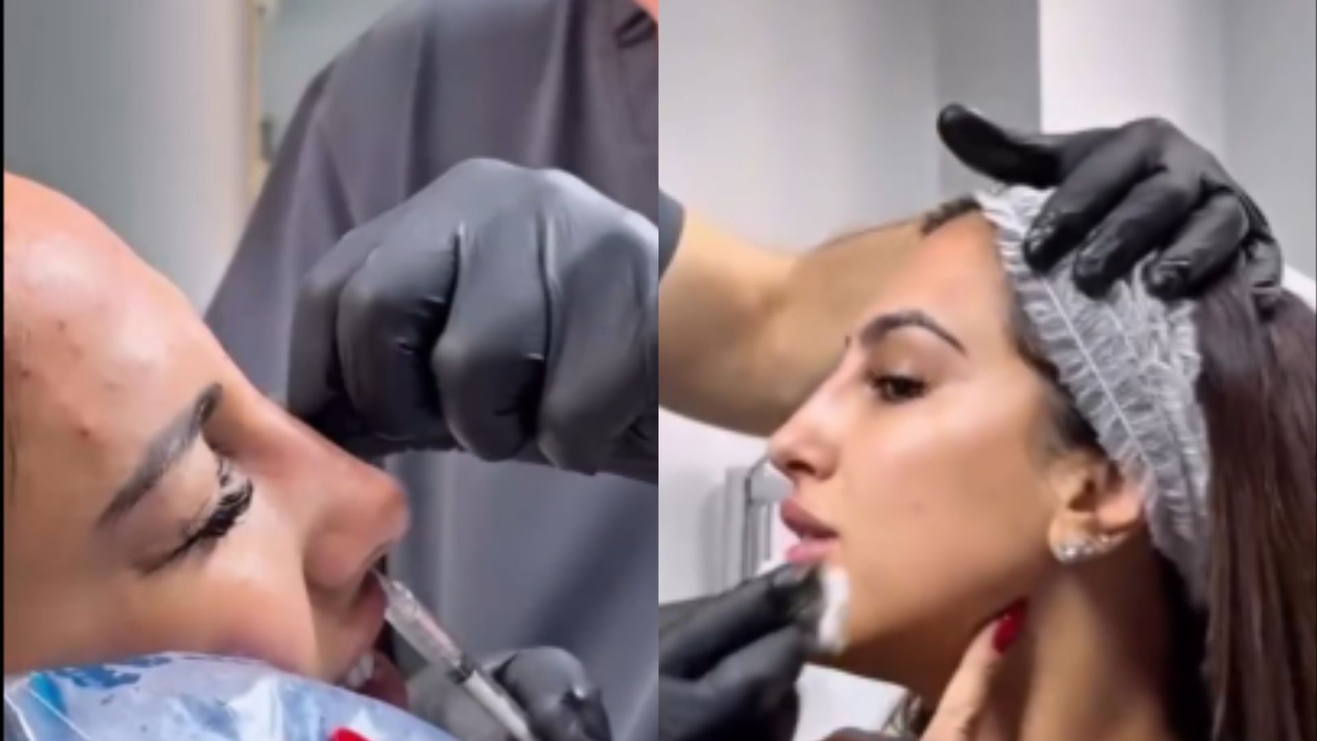 Todas las operaciones estéticas de Noemí Salazar: de sus inicios a su último retoque facial