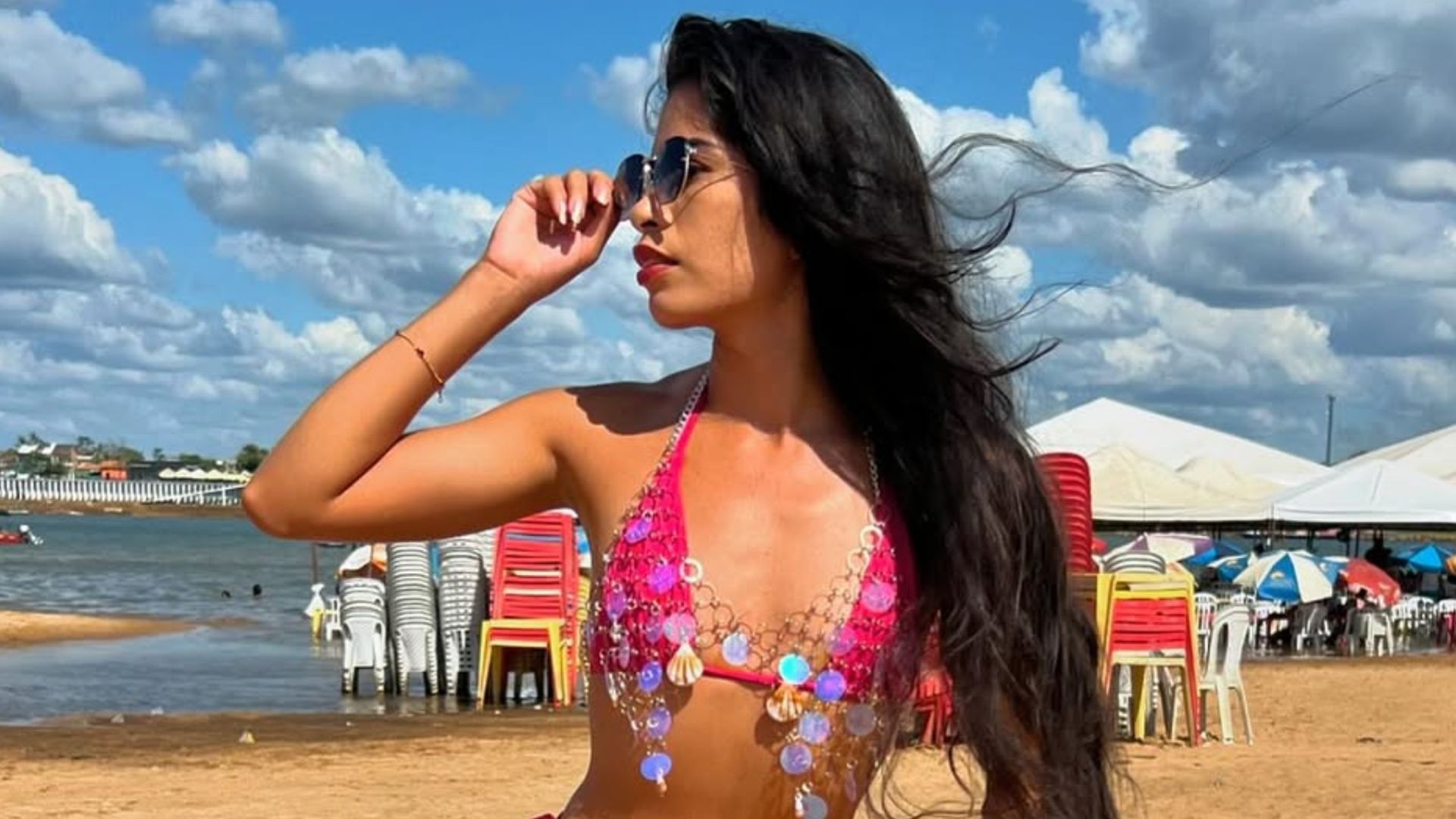 Derleya Alves ha muerto por complicaciones de una cirugía plástica