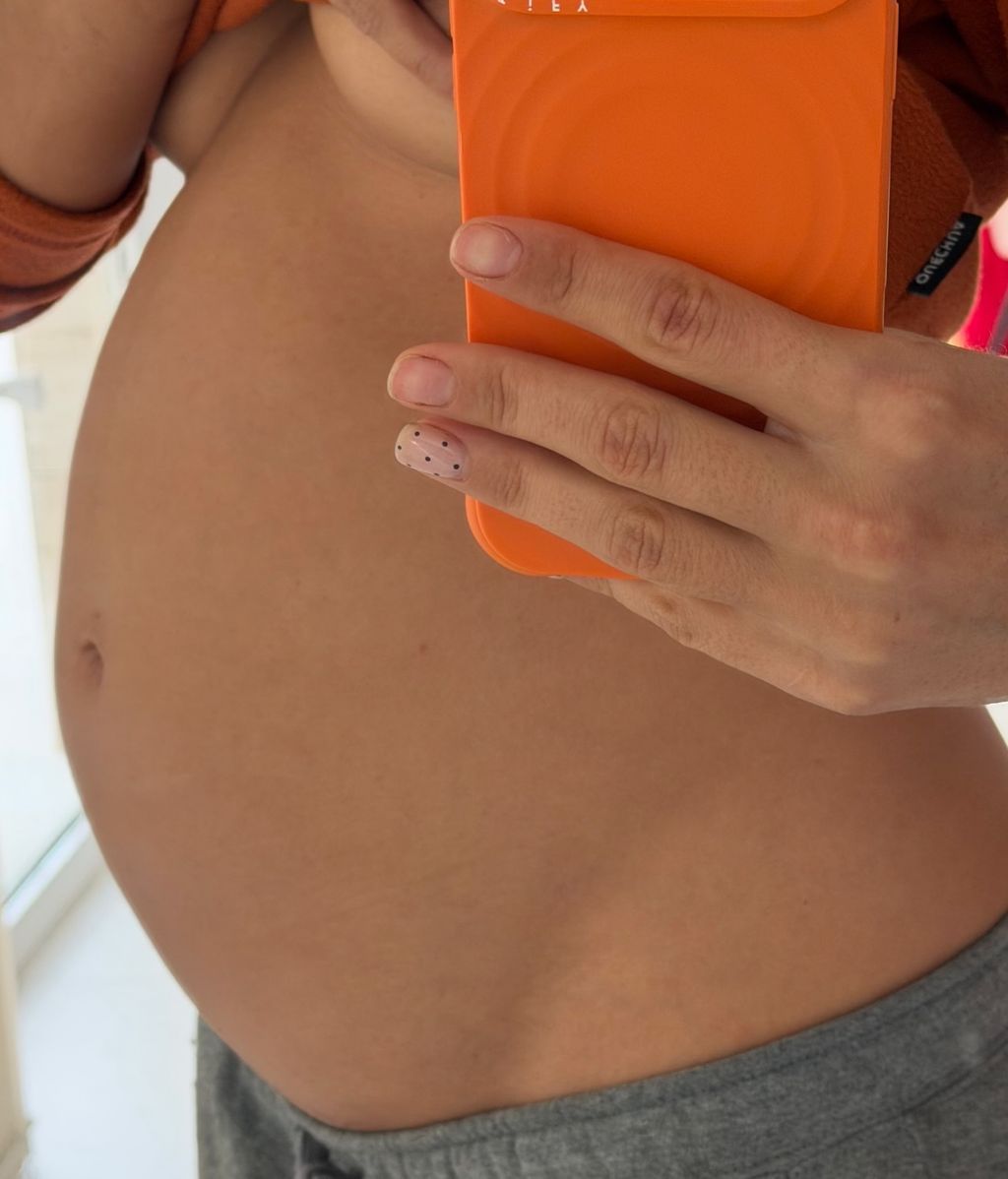 La foto de la inflamación de Sofía Suescun