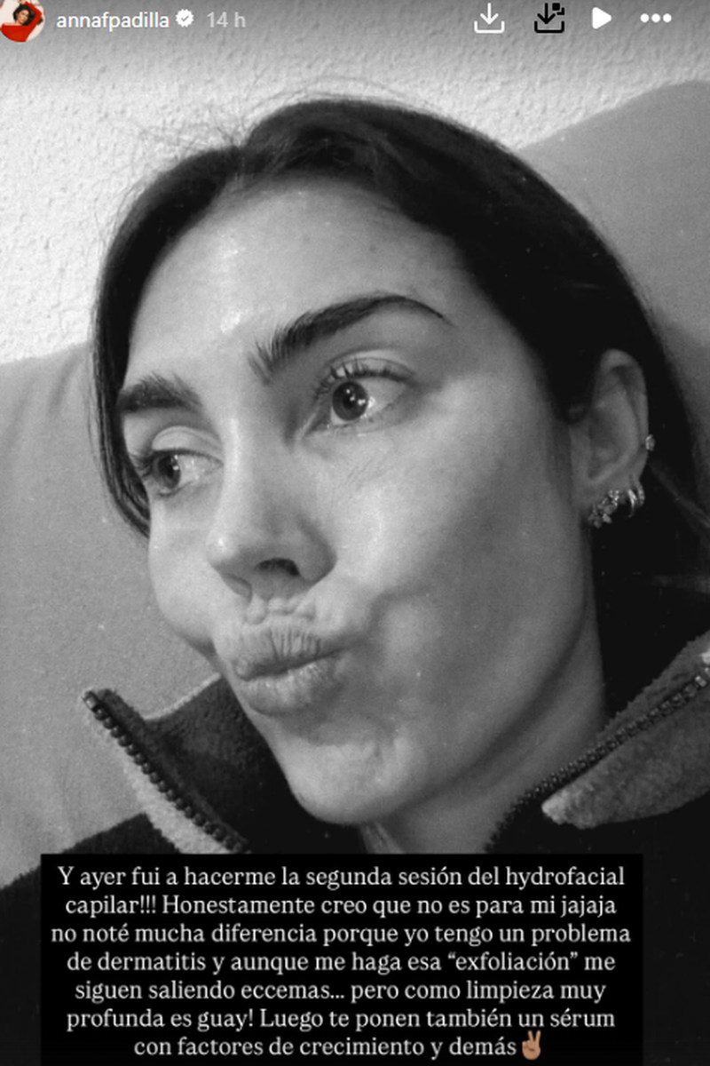 Anna Ferrer Padilla habla de su problema con los eccemas y del último tratamiento al que se está sometiendo
