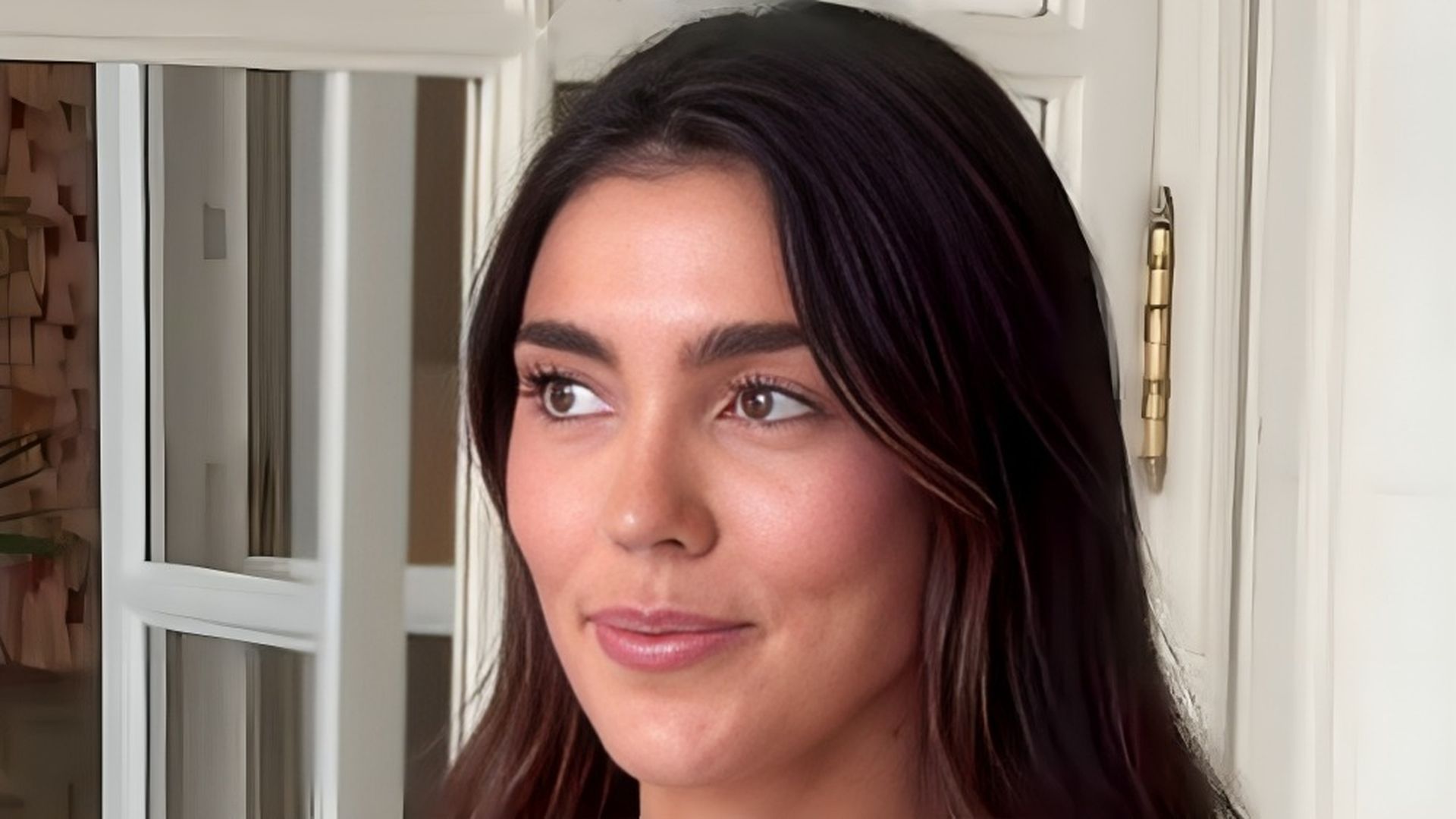 Anna Ferrer Padilla habla del problema que sufre en la piel y por qué no le funciona su último tratamiento Anna Ferrer Padilla habla del problema que sufre en la piel y por qué no le funciona su último tratamiento