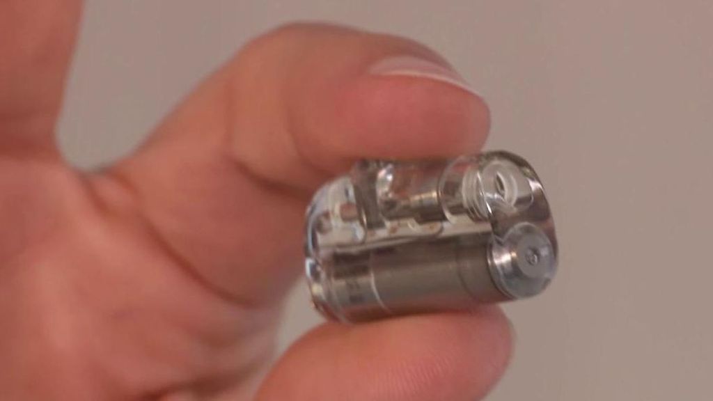 El marcapasos más pequeño del mundo, de 2 centímetros, salva a una bebé de 2,1 kilos