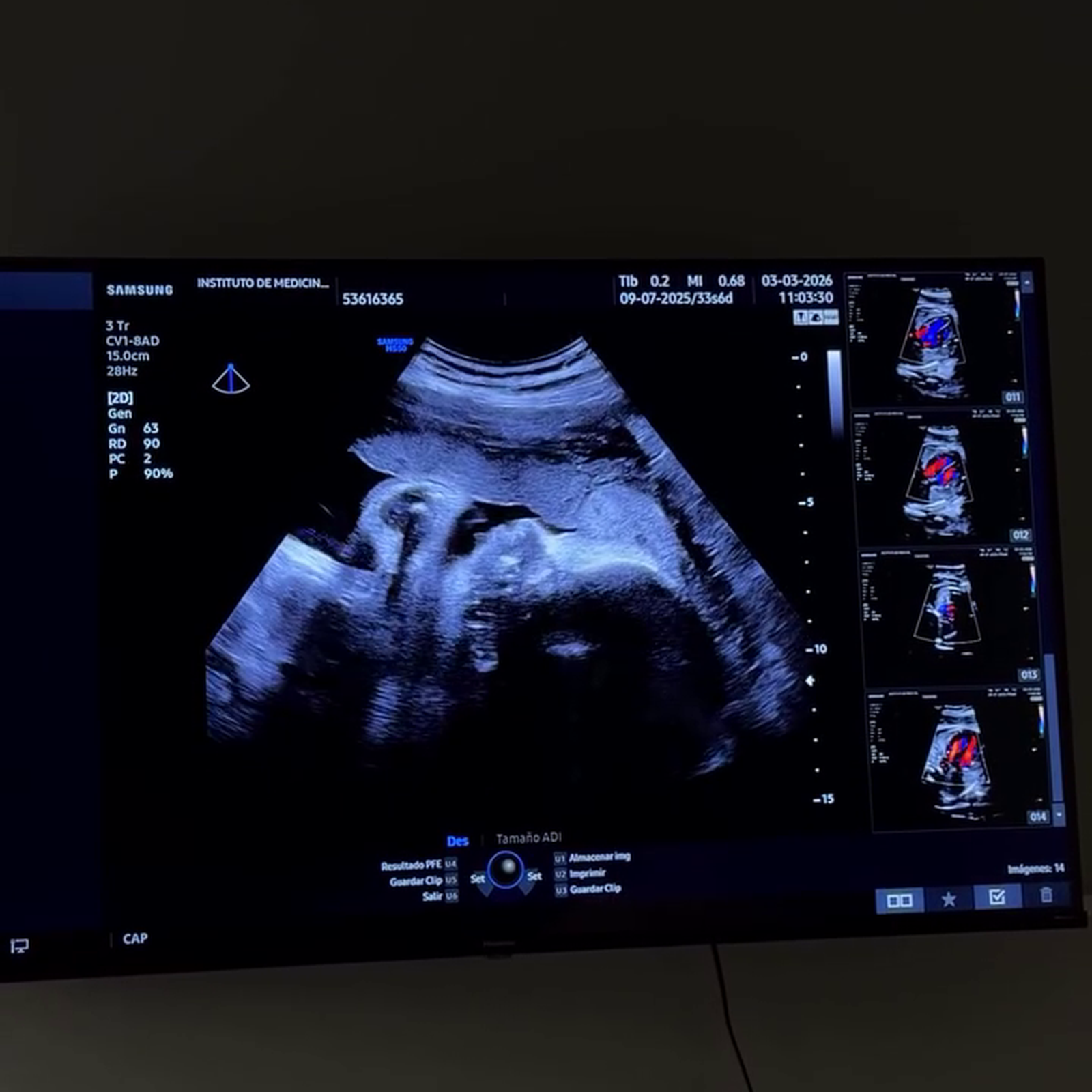 La hija de Rodri Fuertes y Marta Castro