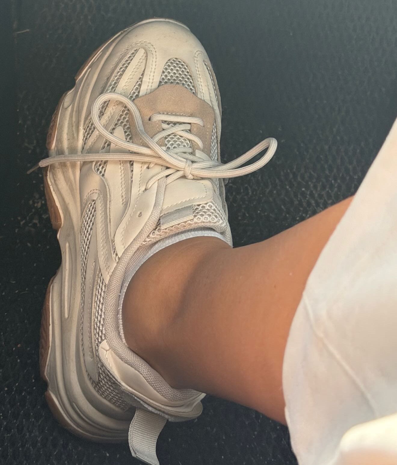 El tobillo de Claudia tras el accidente