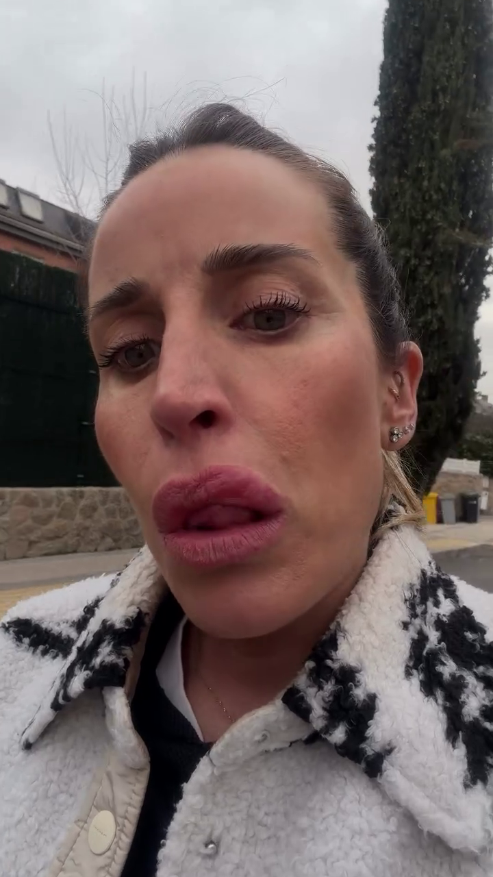 Marta Castro enseña el herpes que le ha salido