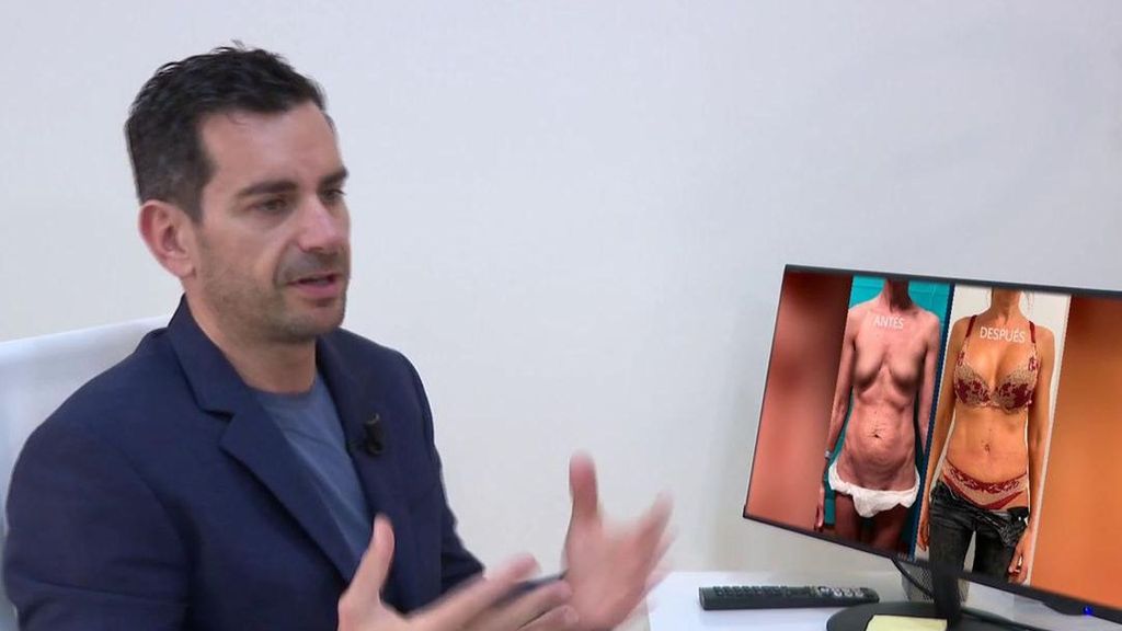 La cirugía que nos hacemos según la edad