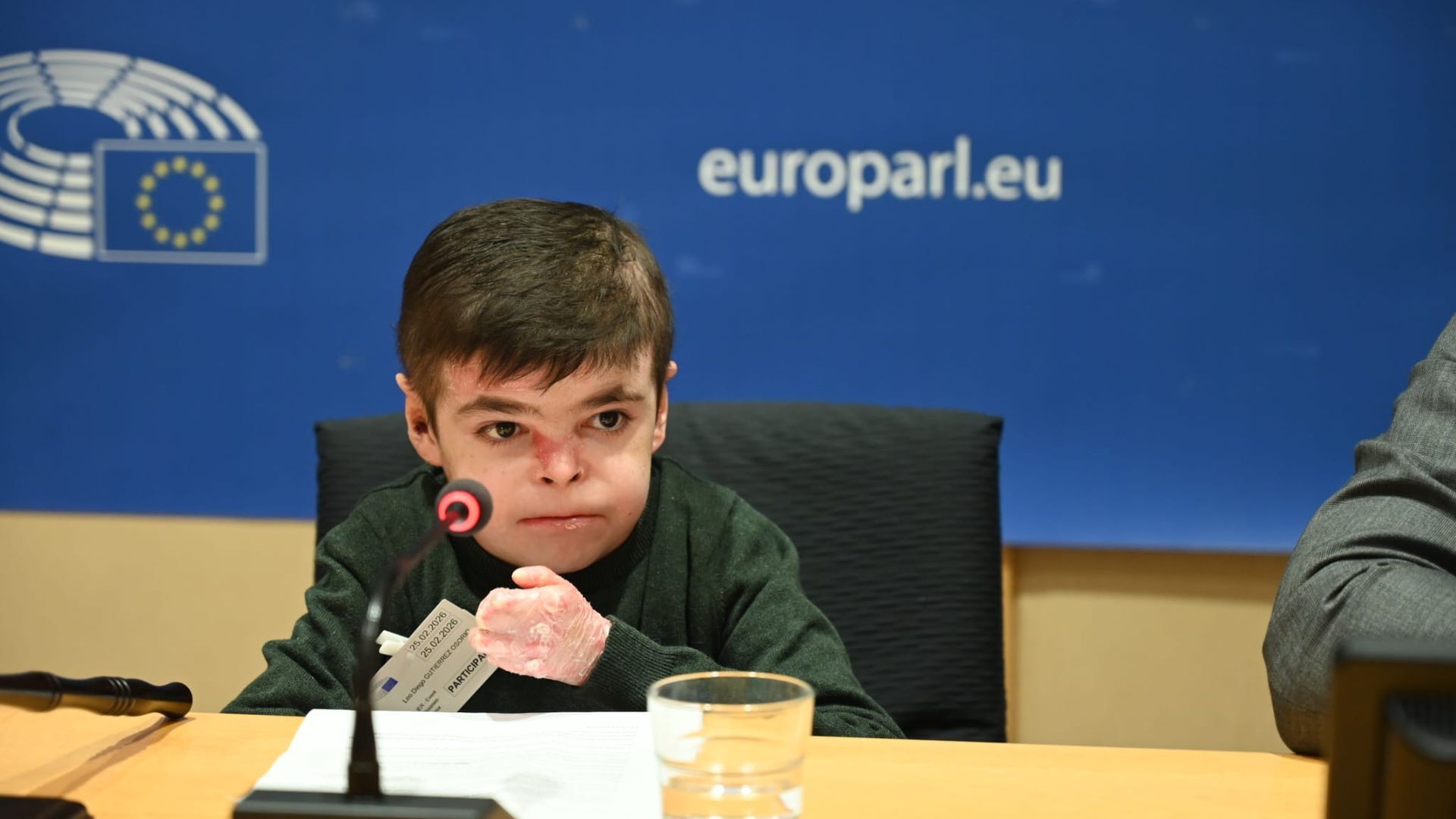 Leo, el niño sevillano con piel de mariposa que ha llegado al Parlamento Europeo