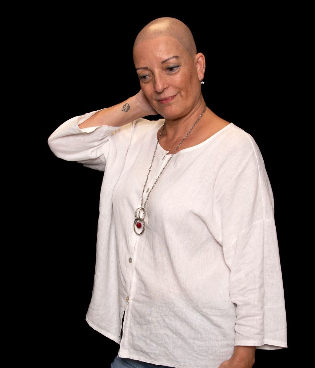 Conchi ha aprendido a quererse y lucir sin verguenza su calva