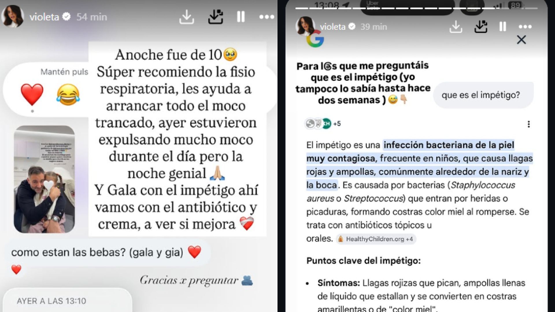 Violeta Mangriñán, sobre el impétigo de su hija Gala