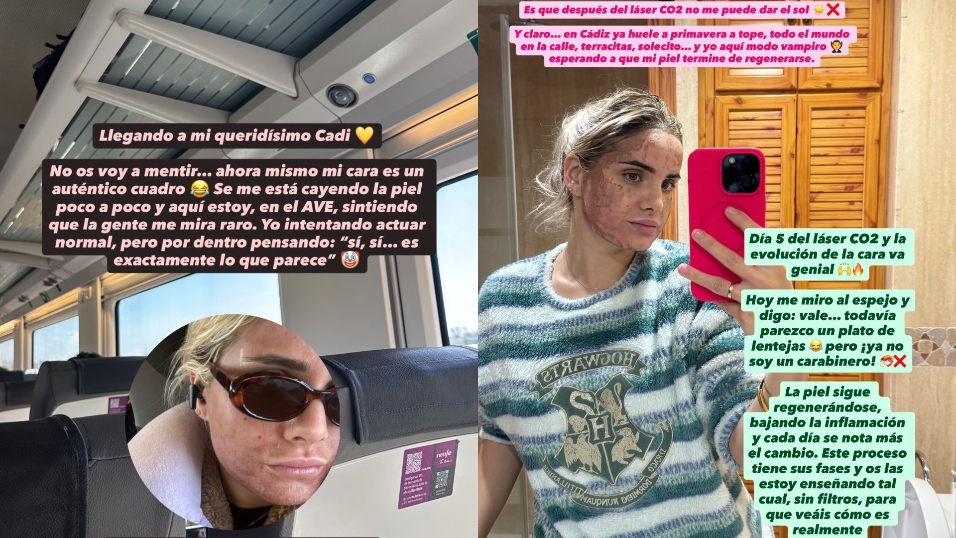 Gloria enseña el impactante estado de su rostro