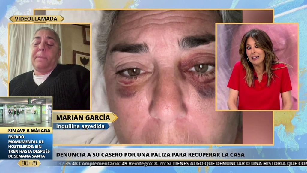 Inquilina agredida por su casero para que abandone su casa: "Vivo en un sin vivir, amenazada de muerte"