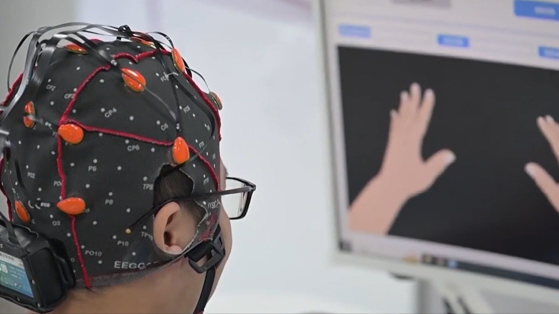 Permite movimientos en los pacientes con lesión medular