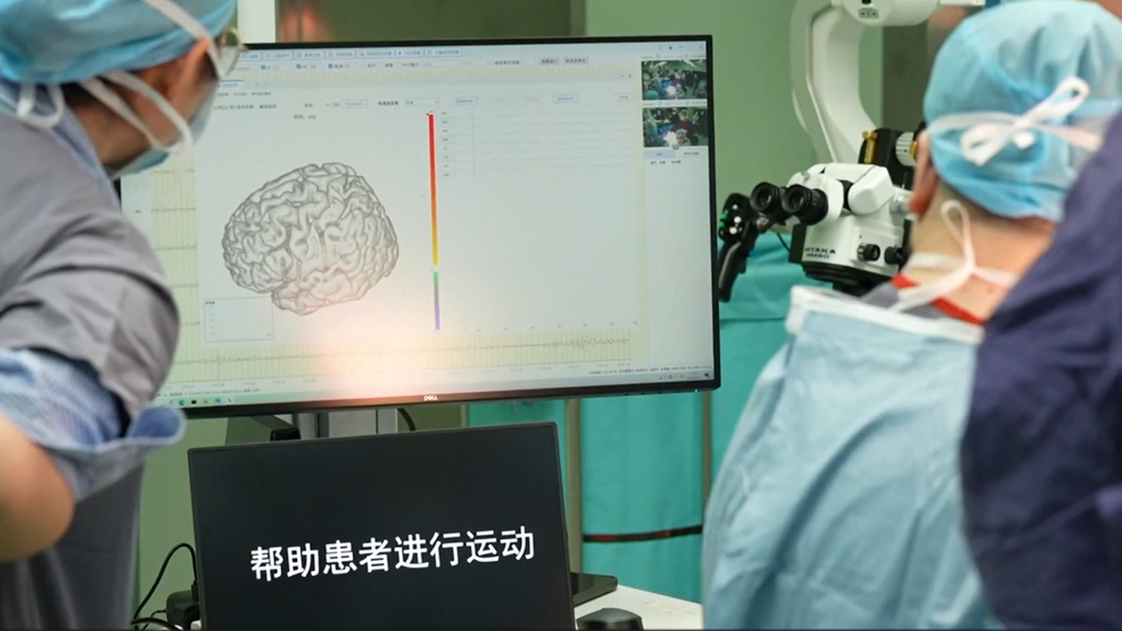 Se comercializa en Shanghái un dispositivo para pacientes con lesiones medulares