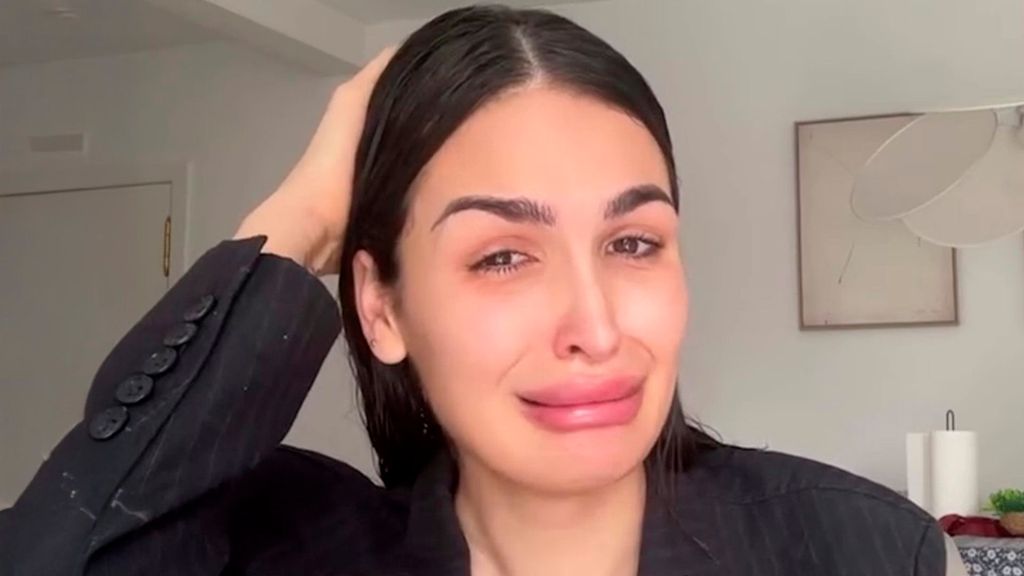 Keyla, de ‘LIDLT’, rompe a llorar y pide ayuda desesperada por un problema capilar