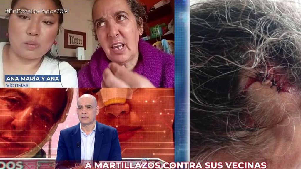 Brutal agresión | Golpea a sus vecinas con un martillo ante la presencia de su bebé en Cáceres: “Tenemos mucho miedo”