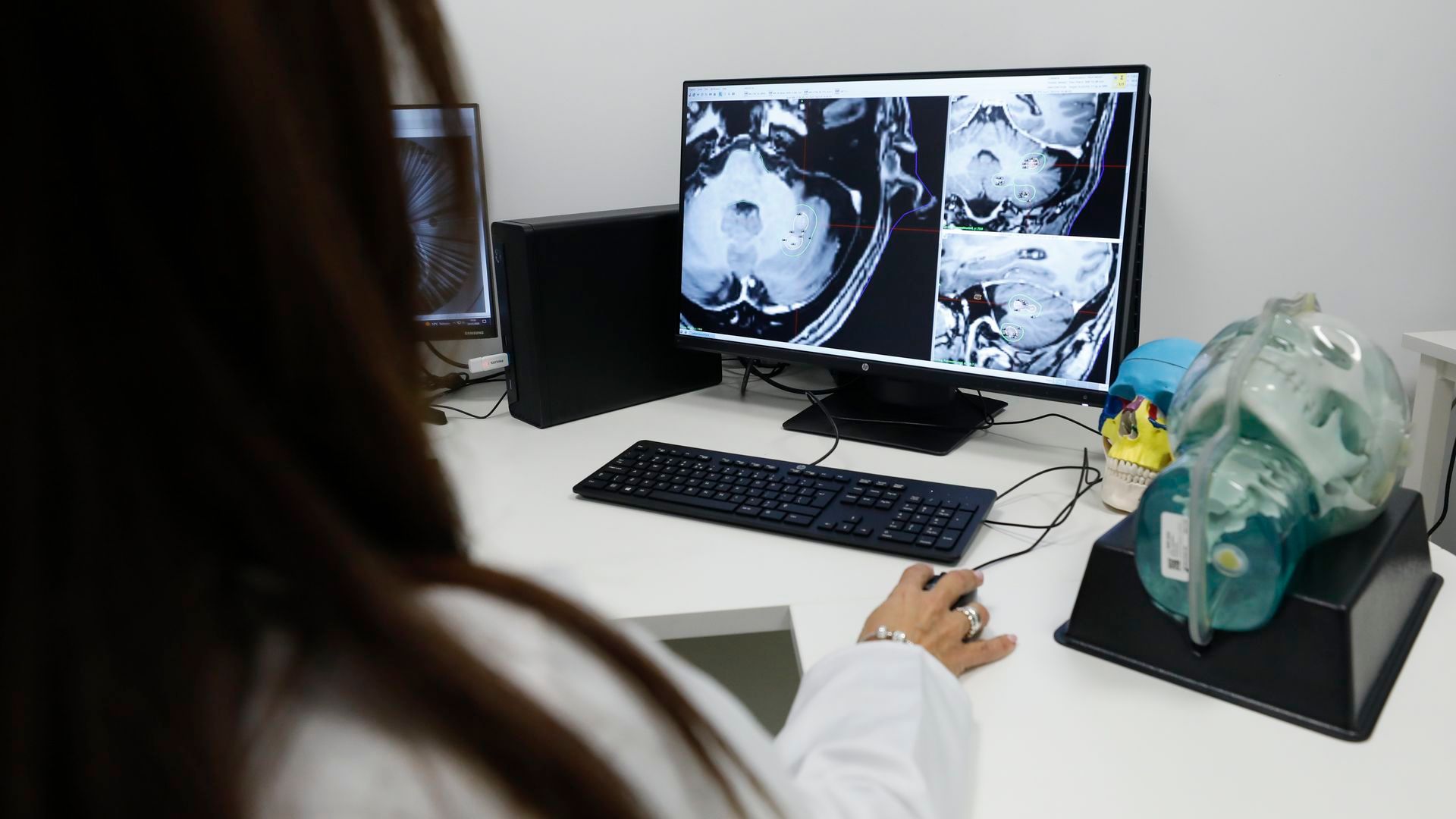 Análisis de un cerebro tras la realización de una resonancia en un hospital Análisis de un cerebro tras la realización de una resonancia en un hospital