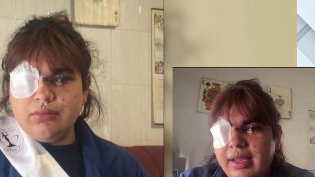 Miss Trans Segovia, víctima de una brutal paliza: "Todavía estoy es estado de shock"