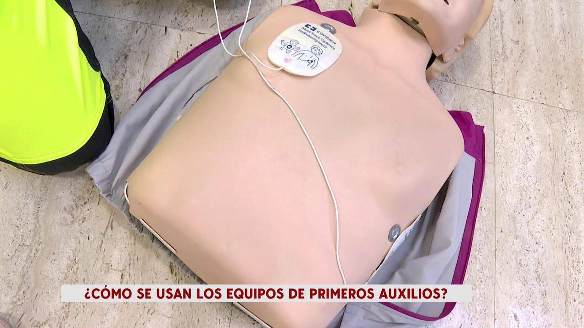 Así se colocan los parches del desfibrilador