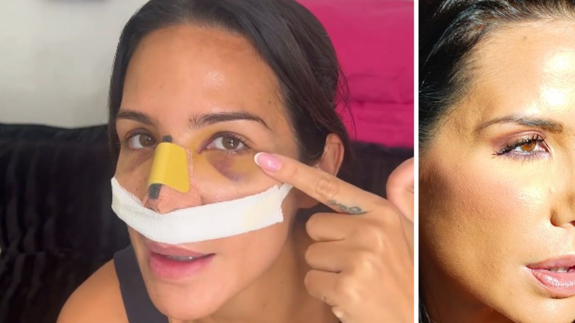 Tamara Gorro enseña el resultado final de su operación de nariz Tamara Gorro enseña el resultado final de su operación de nariz