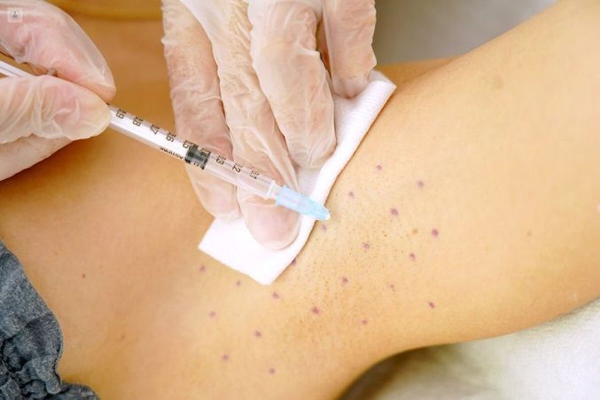 Tratamiento para la Hiperhidrosis