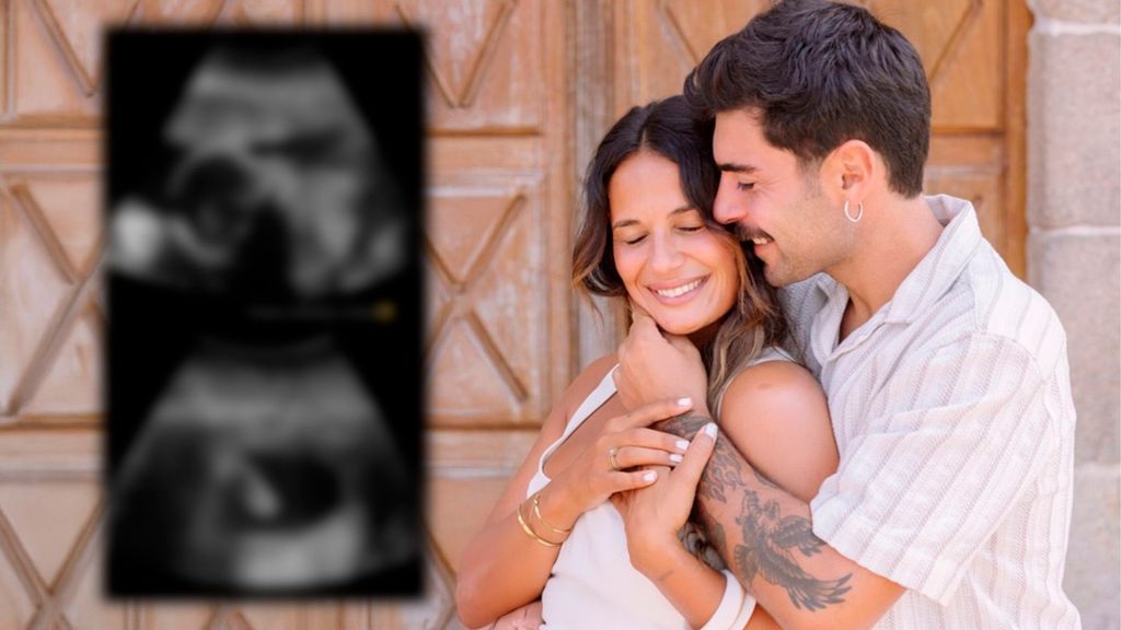 Lara Tronti y Hugo Pérez esperan a su segunda hija en común