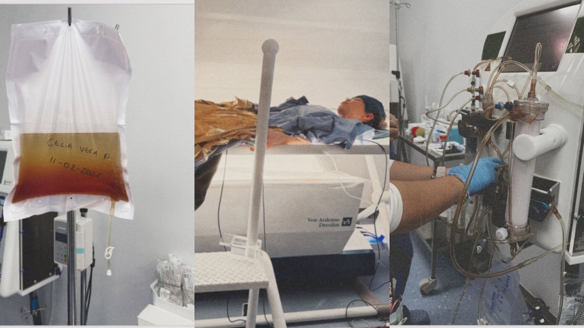 Celia Vega-Penichet, sobrina de Ana Obregón, muestra el impacto de la enfermedad de Lyme en su vida