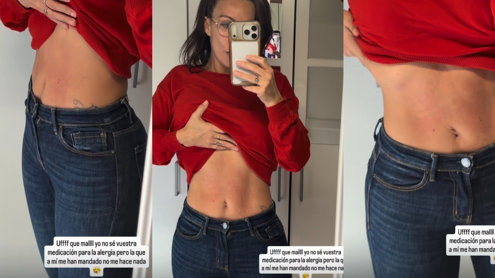 Fani Carbajo sufre un nuevo brote alérgico