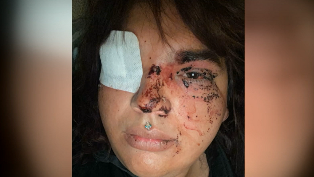 Pasan a disposición judicial las cinco detenidas por la brutal agresión a una mujer trans en La Bañeza, León