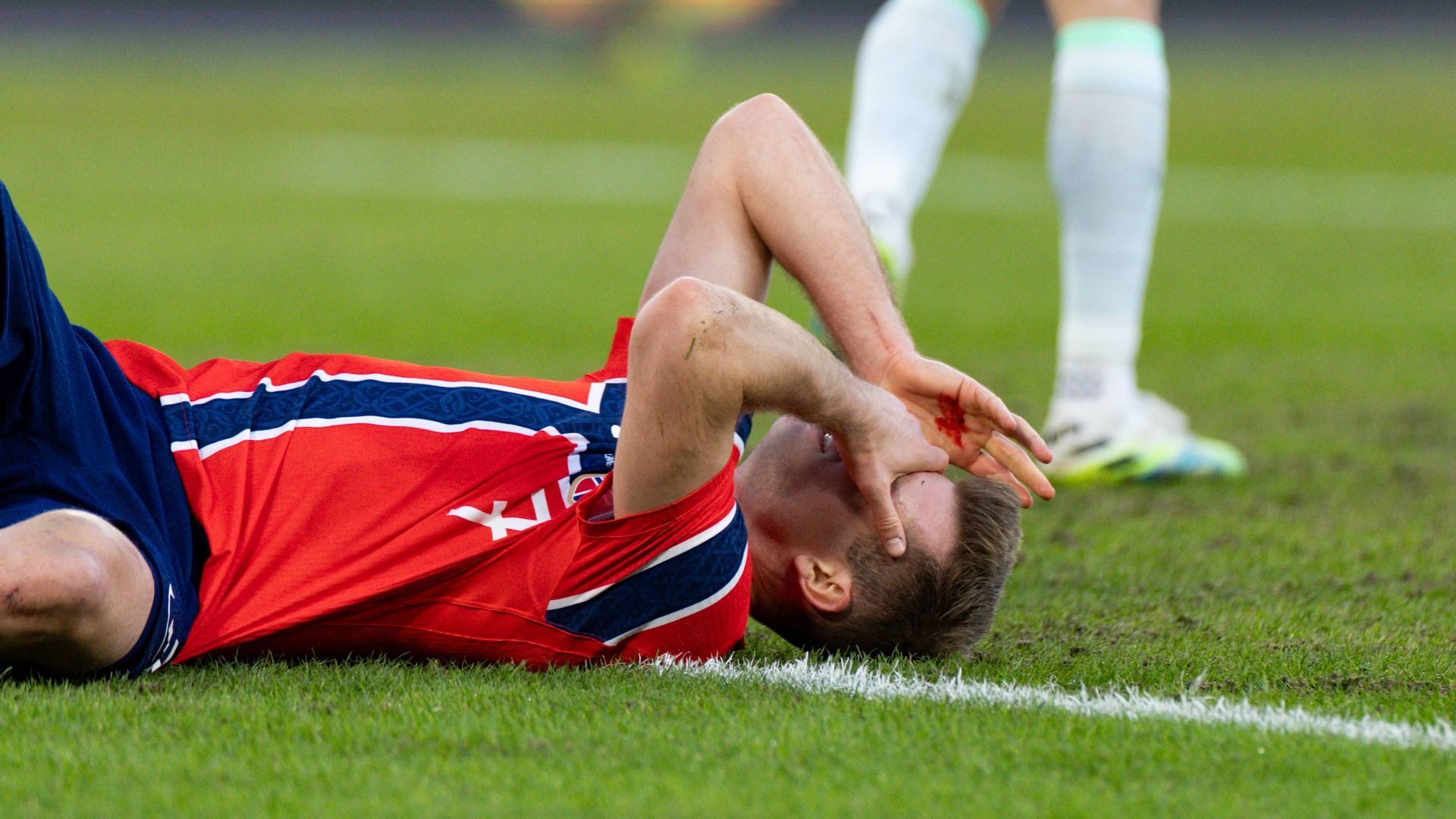 Alexander Sorloth tras su fuerte golpe con Noruega